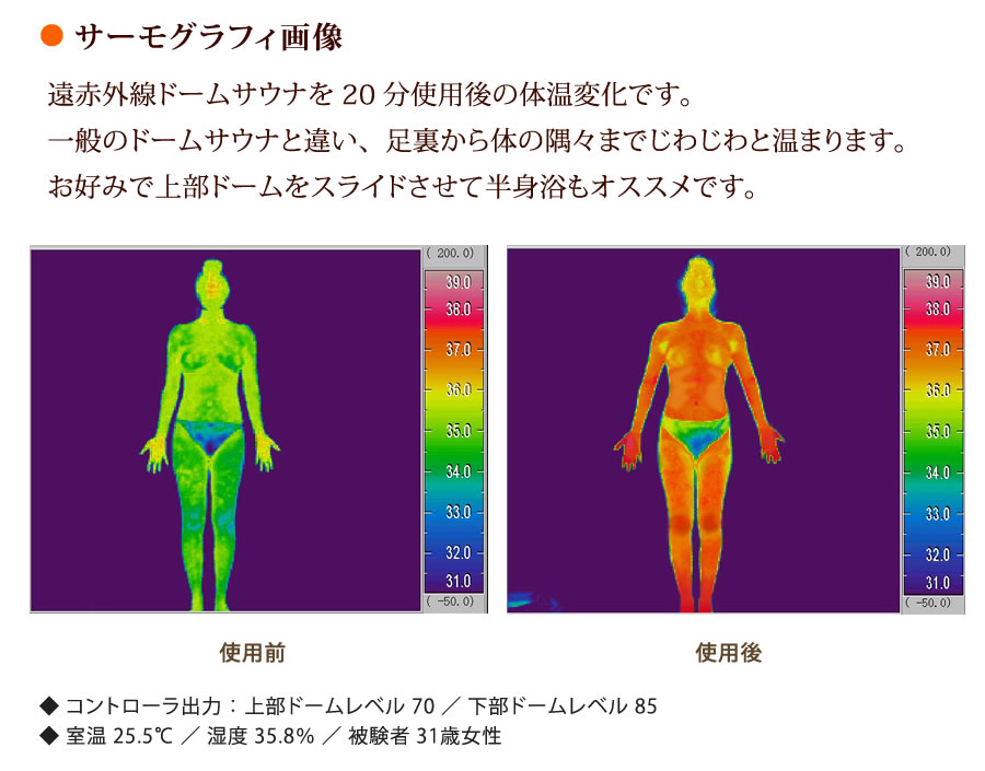 ● サーモグラフィ画像