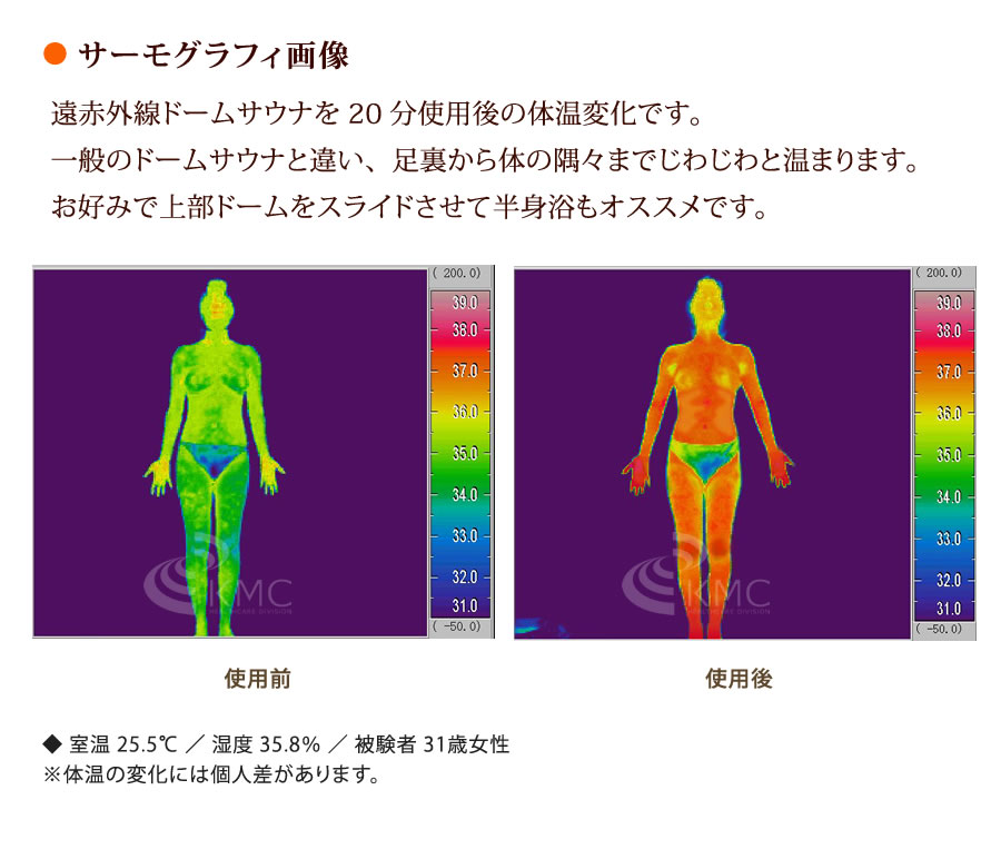 ● サーモグラフィ画像